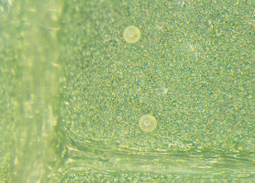 ナミハダニの卵